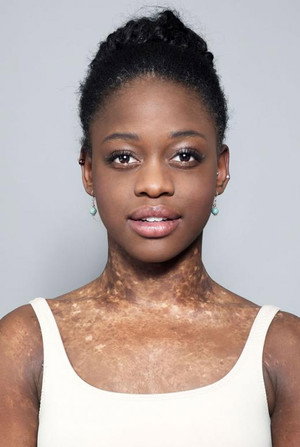Michaela DePrince in The Female Lead - A Selection of Portraits