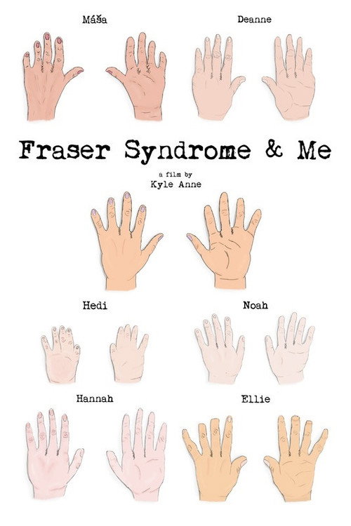 Fraser Syndrome & Me (2018) movie poster