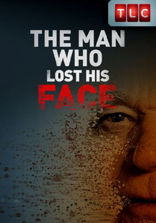 The Man Who Lost His Face (2011) movie poster