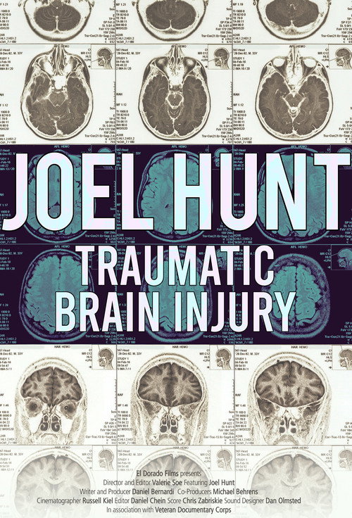 Joel Hunt: Traumatic Brain Injury (TBI) (2015) movie poster