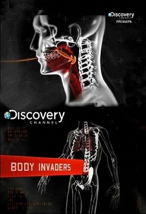 Body Invaders (2012) TV show poster